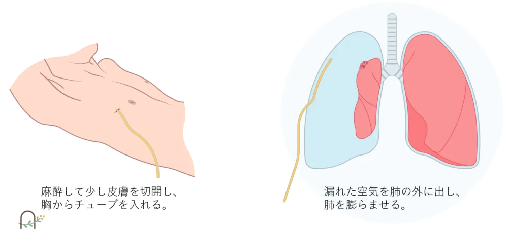 中等症以上の場合