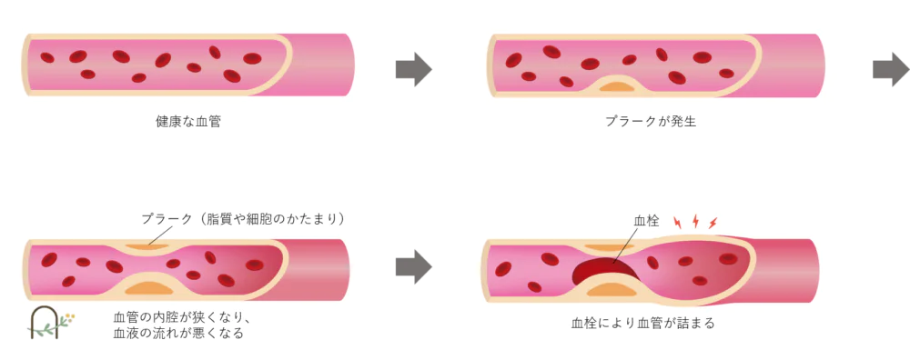 なぜ治療する必要があるの？