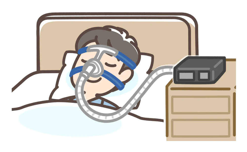 経鼻的持続陽圧呼吸療法（CPAP）