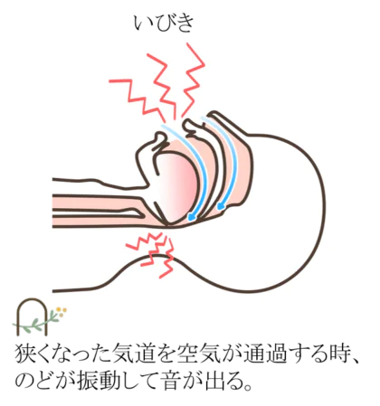 どうして睡眠時無呼吸症候群になってしまうの？